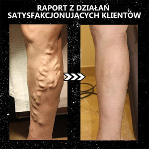 Turmalinowe skarpety jonowe