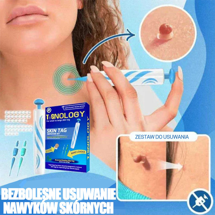 Narzędzie 2 w 1 do usuwania brodawek