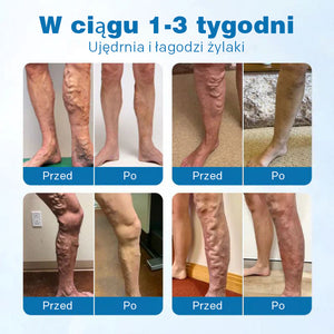 Rozwiązanie do pielęgnacji stóp