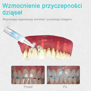 Żel naprawczy do zębów (kup 1, a 1 otrzymasz gratis)