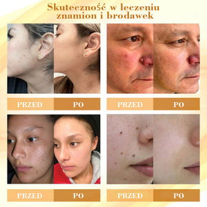 Skoncentrowany krem do naprawy skóry z jadem pszczelim