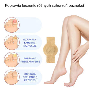 Naklejki na grzybicę paznokci