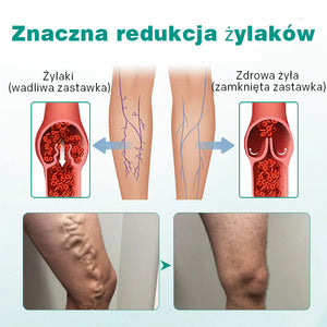 Plaster miejscowy na podniesione żyły