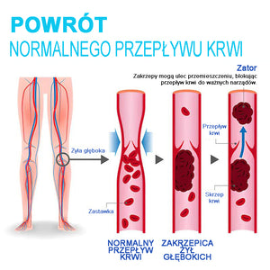 Samonagrzewające się wsparcie kolana Honeycomb Ionic Lymphatic Detox