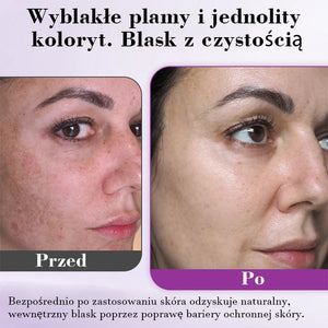 Zaawansowane serum przeciwprzebarwieniom