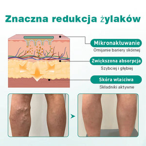 Plaster miejscowy na podniesione żyły