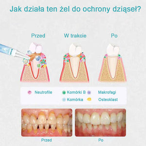 Żel naprawczy do zębów (kup 1, a 1 otrzymasz gratis)